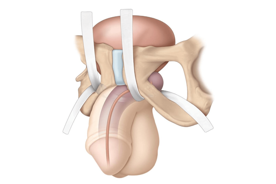 The location of the filler is being investigated