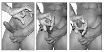 Special exercises to increase penis