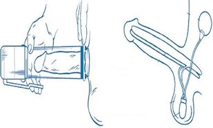 The principle of penis enlargement pump