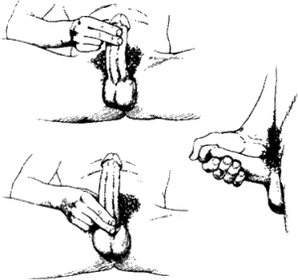 Masturbation and massage can enlarge the penis