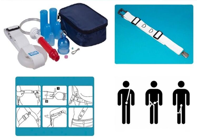Penis lengthening and widening can be achieved with a stretcher